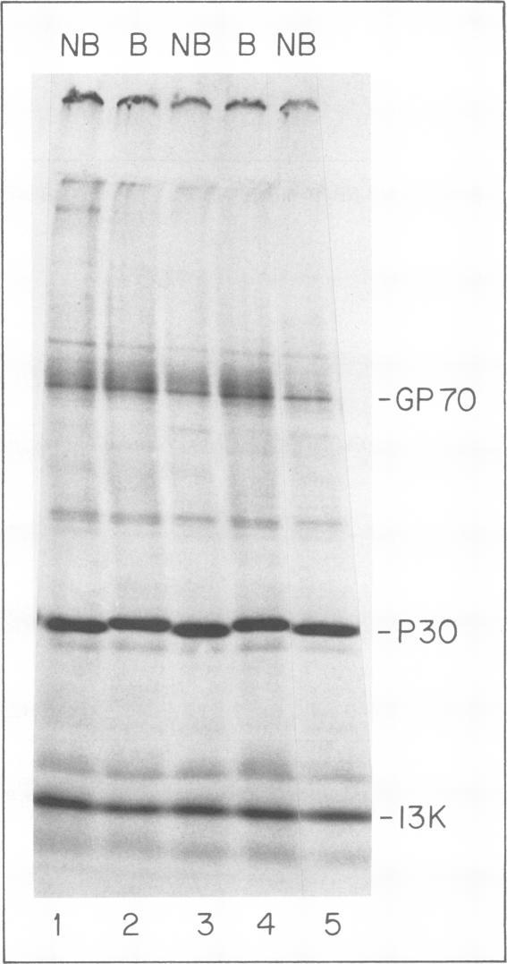 https://cdn.ncbi.nlm.nih.gov/pmc/blobs/f81d/353817/06e2e8a4eaca/jvirol00205-0330-a.jpg