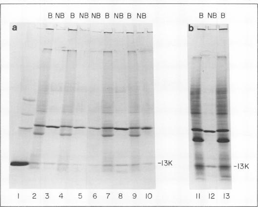 https://cdn.ncbi.nlm.nih.gov/pmc/blobs/f81d/353817/78c40034d8ea/jvirol00205-0329-a.jpg