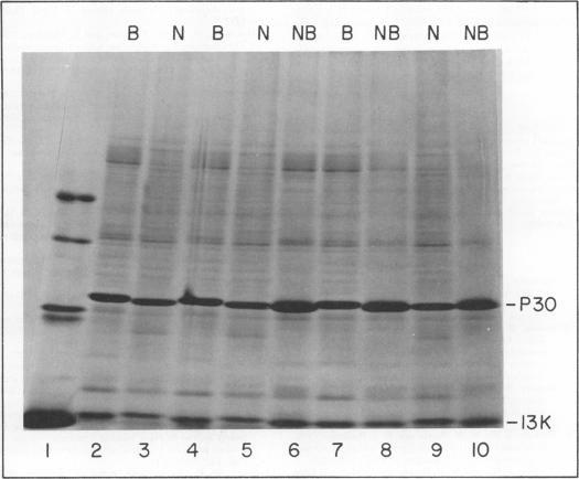 https://cdn.ncbi.nlm.nih.gov/pmc/blobs/f81d/353817/ffd564b13096/jvirol00205-0331-a.jpg
