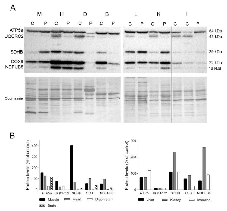 https://cdn.ncbi.nlm.nih.gov/pmc/blobs/f820/8199166/0bf90bf05f28/ijms-22-05598-g002.jpg