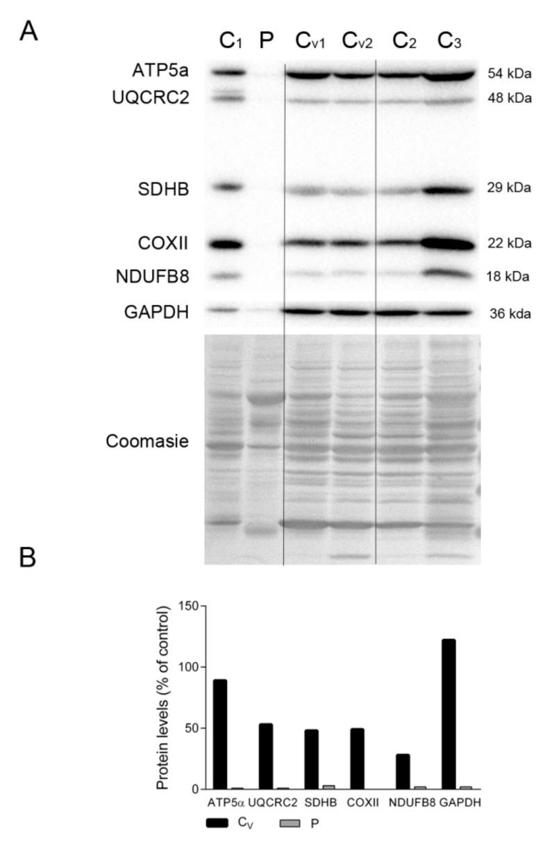 https://cdn.ncbi.nlm.nih.gov/pmc/blobs/f820/8199166/a1d7e2395a9b/ijms-22-05598-g004.jpg