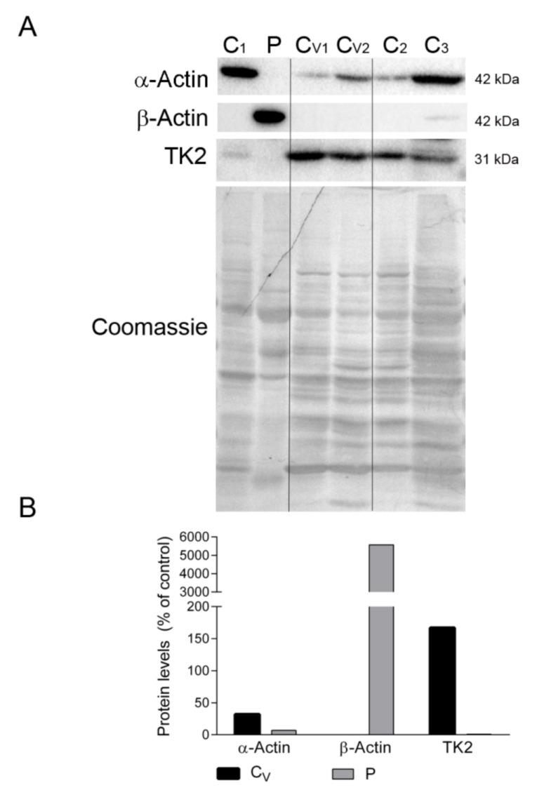 https://cdn.ncbi.nlm.nih.gov/pmc/blobs/f820/8199166/df1d2fbdfd6a/ijms-22-05598-g005.jpg