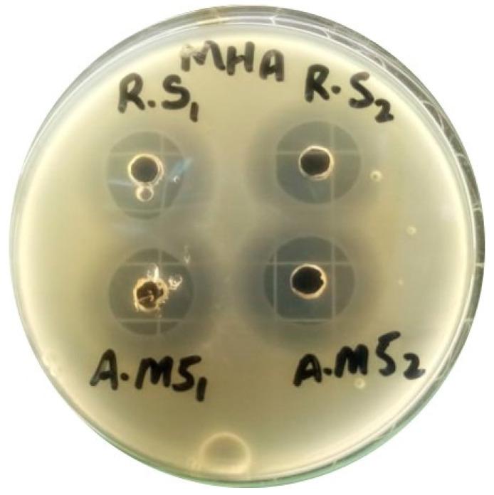 https://cdn.ncbi.nlm.nih.gov/pmc/blobs/f832/10379863/9e5c7f1750cd/gels-09-00551-g011.jpg