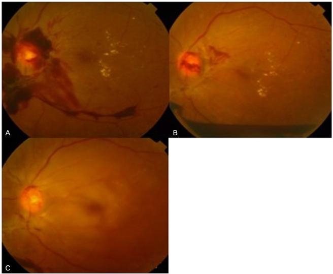 https://cdn.ncbi.nlm.nih.gov/pmc/blobs/f83c/2789950/425d8d709f16/kjo-23-266-g003.jpg