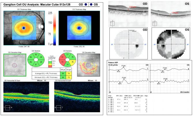 https://cdn.ncbi.nlm.nih.gov/pmc/blobs/f842/12023439/dabe82985ebd/12886_2025_4057_Fig3_HTML.jpg