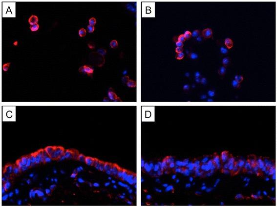 https://cdn.ncbi.nlm.nih.gov/pmc/blobs/f845/4364338/883dc0f5e63d/12931_2015_201_Fig5_HTML.jpg