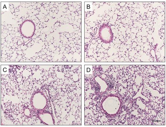 https://cdn.ncbi.nlm.nih.gov/pmc/blobs/f845/4364338/da24dbd4db0a/12931_2015_201_Fig3_HTML.jpg