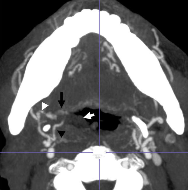 https://cdn.ncbi.nlm.nih.gov/pmc/blobs/f849/10063472/143cbec69d3a/10140_2023_2118_Fig3_HTML.jpg