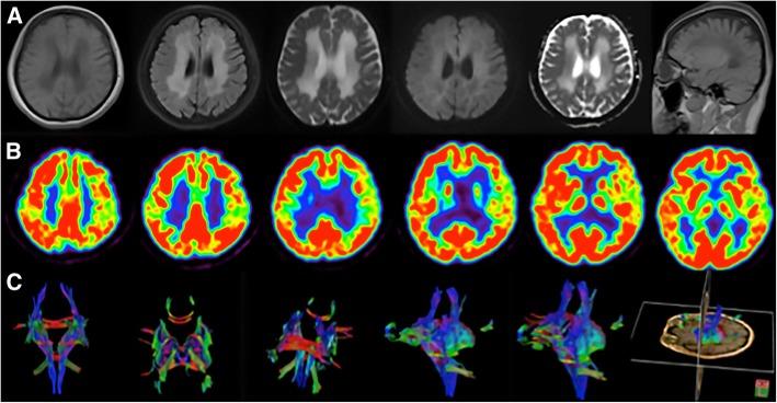 https://cdn.ncbi.nlm.nih.gov/pmc/blobs/f84a/6704498/65799b1de031/12883_2019_1429_Fig1_HTML.jpg