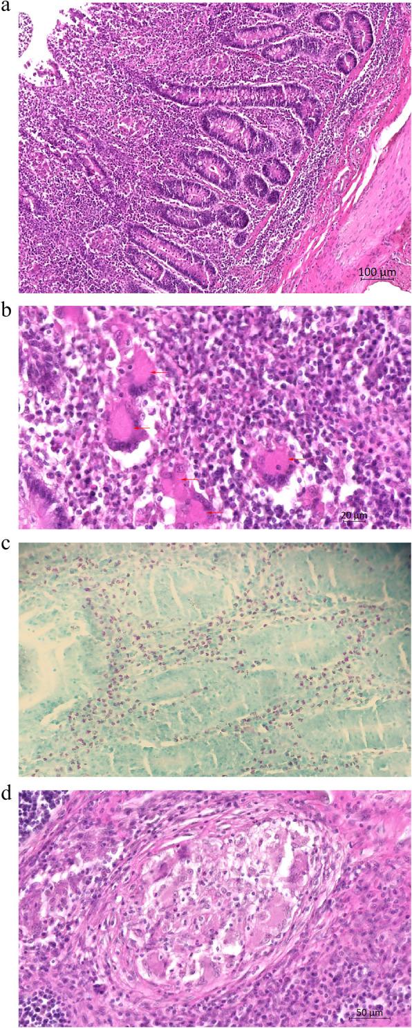 https://cdn.ncbi.nlm.nih.gov/pmc/blobs/f84b/12039145/6b1a80c9fd21/12917_2025_4765_Fig6_HTML.jpg