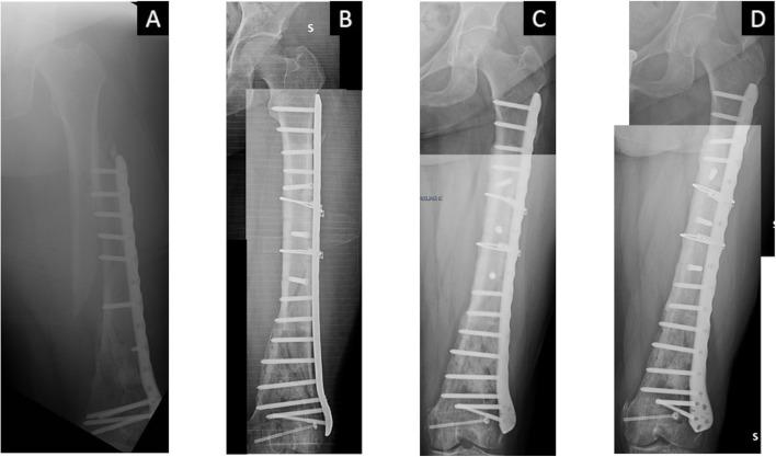 https://cdn.ncbi.nlm.nih.gov/pmc/blobs/f84d/10007805/33bc02a29db9/12891_2023_6278_Fig3_HTML.jpg