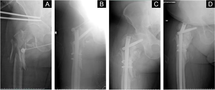 https://cdn.ncbi.nlm.nih.gov/pmc/blobs/f84d/10007805/4d75dc76290f/12891_2023_6278_Fig1_HTML.jpg