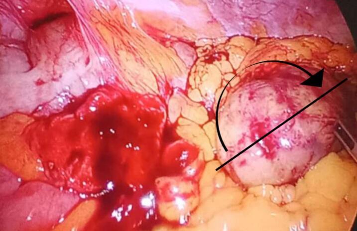 https://cdn.ncbi.nlm.nih.gov/pmc/blobs/f853/11245921/733d15e90af0/gr2.jpg