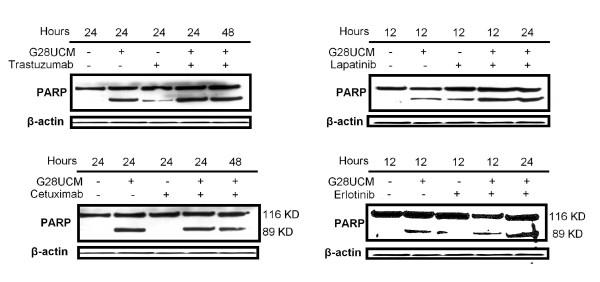 https://cdn.ncbi.nlm.nih.gov/pmc/blobs/f853/3326573/9342327f52a0/bcr3077-2.jpg