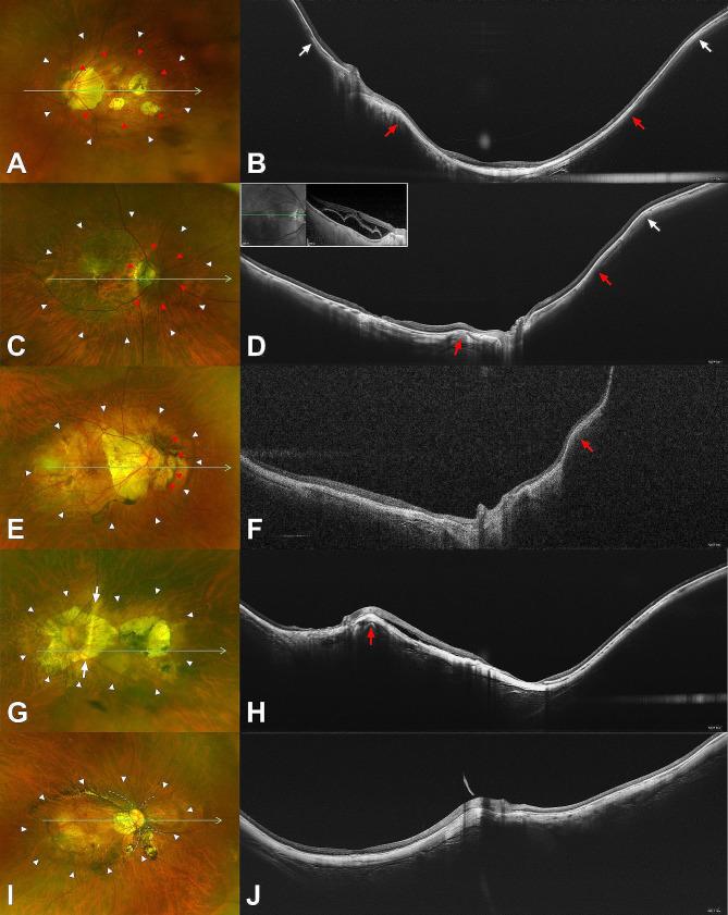 https://cdn.ncbi.nlm.nih.gov/pmc/blobs/f85d/11165867/9224ed6b2ba7/12886_2024_3519_Fig2_HTML.jpg