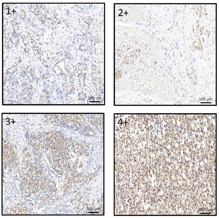 https://cdn.ncbi.nlm.nih.gov/pmc/blobs/f866/9221628/31aec9f064f7/diagnostics-12-01502-g003.jpg