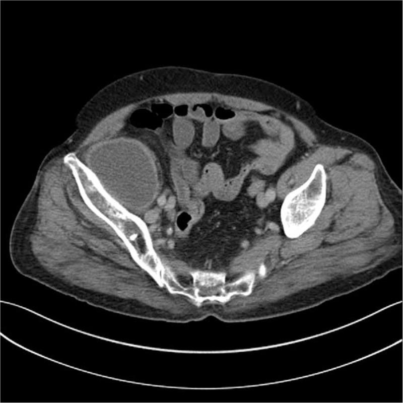 https://cdn.ncbi.nlm.nih.gov/pmc/blobs/f86f/6635227/5c0a258077e5/medi-98-e16322-g002.jpg
