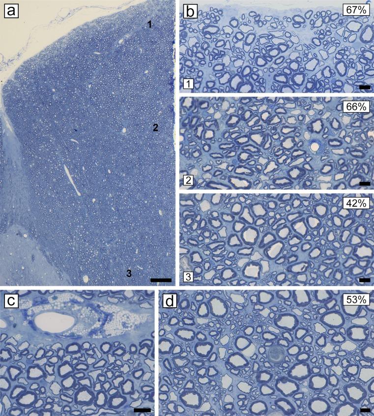 https://cdn.ncbi.nlm.nih.gov/pmc/blobs/f876/6980670/3287d048c7e0/pone.0228109.g010.jpg