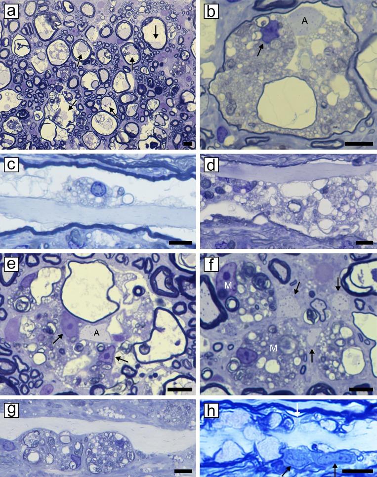 https://cdn.ncbi.nlm.nih.gov/pmc/blobs/f876/6980670/5f26d693d578/pone.0228109.g004.jpg