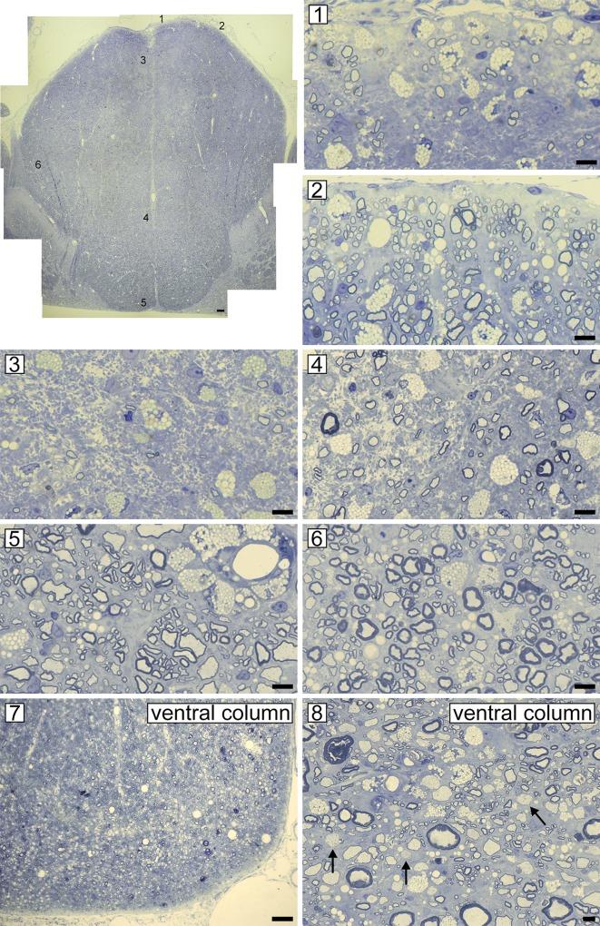 https://cdn.ncbi.nlm.nih.gov/pmc/blobs/f876/6980670/8e415e2d8abf/pone.0228109.g008.jpg