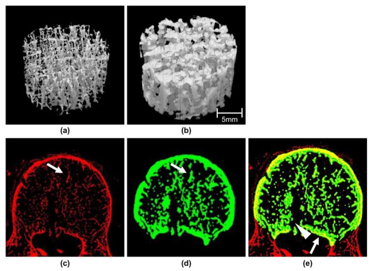 https://cdn.ncbi.nlm.nih.gov/pmc/blobs/f877/10093188/fd4dd0d3ad1c/diagnostics-13-01240-g003.jpg