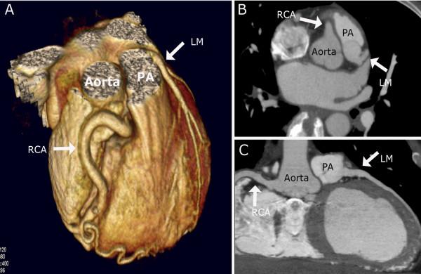 https://cdn.ncbi.nlm.nih.gov/pmc/blobs/f877/2414822/22376f1f55e9/1749-8090-3-33-2.jpg