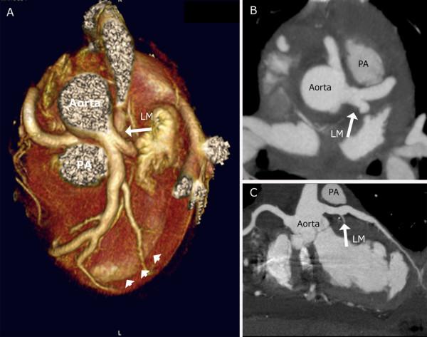 https://cdn.ncbi.nlm.nih.gov/pmc/blobs/f877/2414822/c491972b4f0b/1749-8090-3-33-3.jpg
