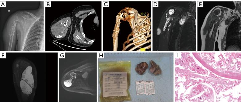 https://cdn.ncbi.nlm.nih.gov/pmc/blobs/f87a/12209645/b6c4f0918be8/qims-15-06-5884-f1.jpg