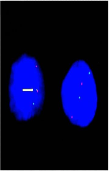 https://cdn.ncbi.nlm.nih.gov/pmc/blobs/f883/4374372/376701dc6c49/12885_2015_1122_Fig1_HTML.jpg