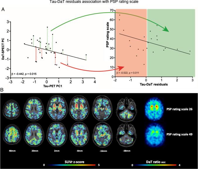https://cdn.ncbi.nlm.nih.gov/pmc/blobs/f887/11139736/273021112fc7/259_2024_6637_Fig4_HTML.jpg