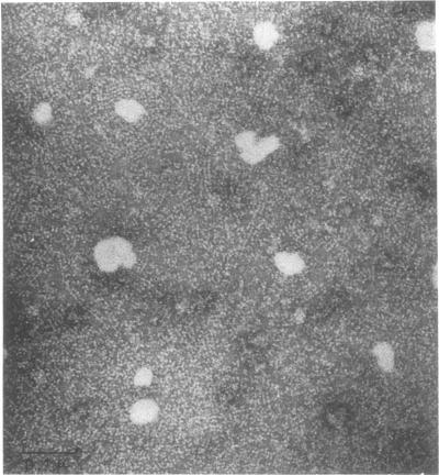 https://cdn.ncbi.nlm.nih.gov/pmc/blobs/f88e/223696/0dbb1af3aa72/pnas00105-0372-a.jpg