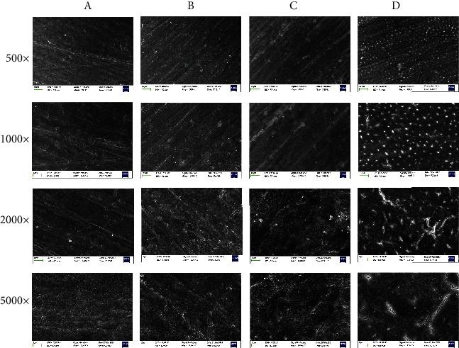 https://cdn.ncbi.nlm.nih.gov/pmc/blobs/f88e/8712178/2be4f7b2aadb/SCANNING2021-6400605.001.jpg