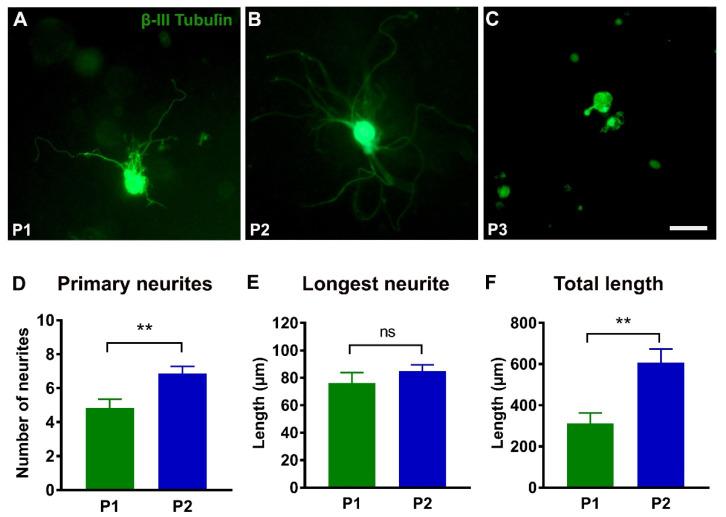 https://cdn.ncbi.nlm.nih.gov/pmc/blobs/f88f/9369339/e339d0527a34/ijms-23-08746-g005.jpg