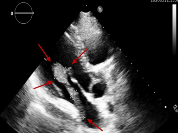 https://cdn.ncbi.nlm.nih.gov/pmc/blobs/f890/9481220/d0b8a12c803a/cureus-0014-00000027859-i02.jpg