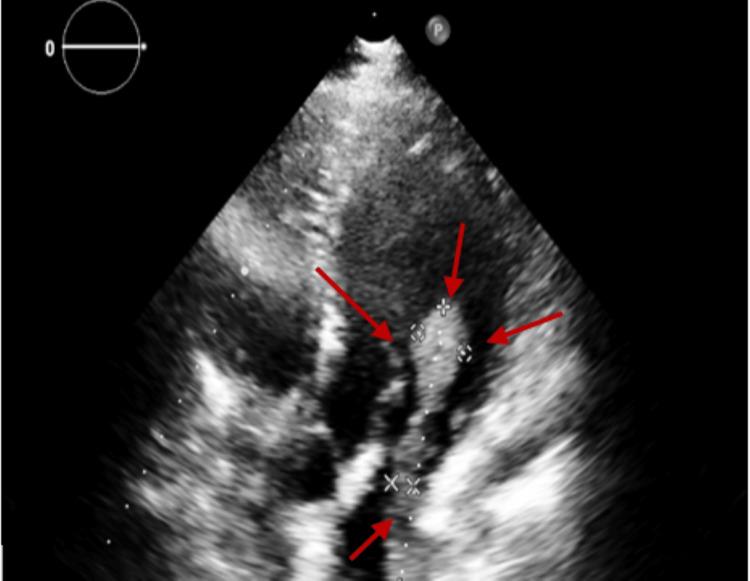 https://cdn.ncbi.nlm.nih.gov/pmc/blobs/f890/9481220/e459c87e1039/cureus-0014-00000027859-i01.jpg