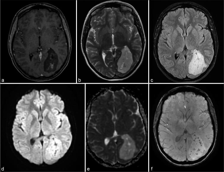 https://cdn.ncbi.nlm.nih.gov/pmc/blobs/f894/8088500/5aadb26847a3/SNI-12-154-g001.jpg