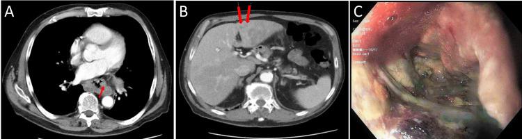 https://cdn.ncbi.nlm.nih.gov/pmc/blobs/f897/9707608/b360eb3b22bf/cureus-0014-00000030874-i02.jpg