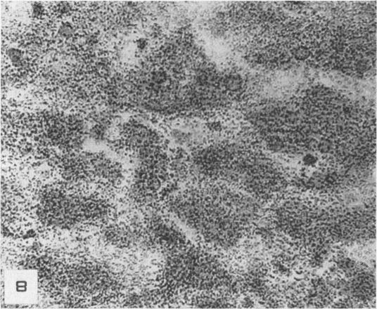 https://cdn.ncbi.nlm.nih.gov/pmc/blobs/f89c/1942923/80e6e8fa5d6b/amjpathol00601-0273-a.jpg
