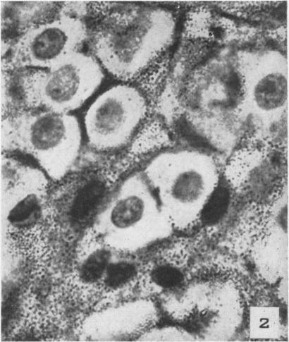 https://cdn.ncbi.nlm.nih.gov/pmc/blobs/f89c/1942923/873b35aa7806/amjpathol00601-0269-b.jpg