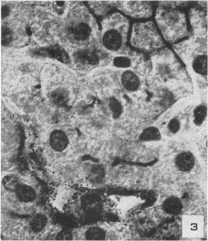https://cdn.ncbi.nlm.nih.gov/pmc/blobs/f89c/1942923/bb207e1ccacc/amjpathol00601-0269-c.jpg