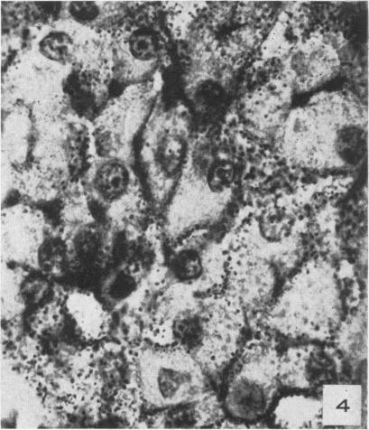 https://cdn.ncbi.nlm.nih.gov/pmc/blobs/f89c/1942923/d25ce17fa192/amjpathol00601-0269-d.jpg