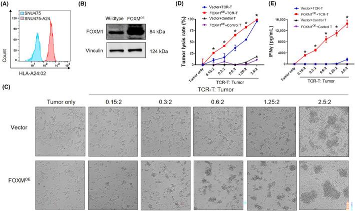 https://cdn.ncbi.nlm.nih.gov/pmc/blobs/f8a6/11463088/3bf35bb3bfa9/CAS-115-3041-g005.jpg