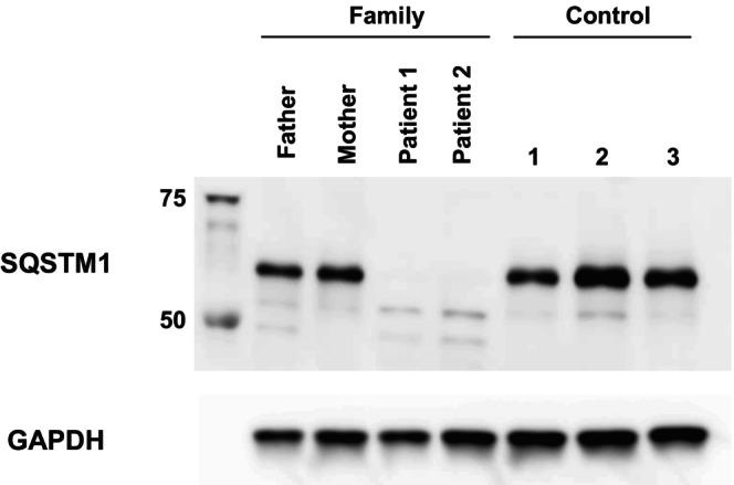 https://cdn.ncbi.nlm.nih.gov/pmc/blobs/f8b2/11588856/6f39f6a3bb7f/MGG3-12-e70044-g001.jpg