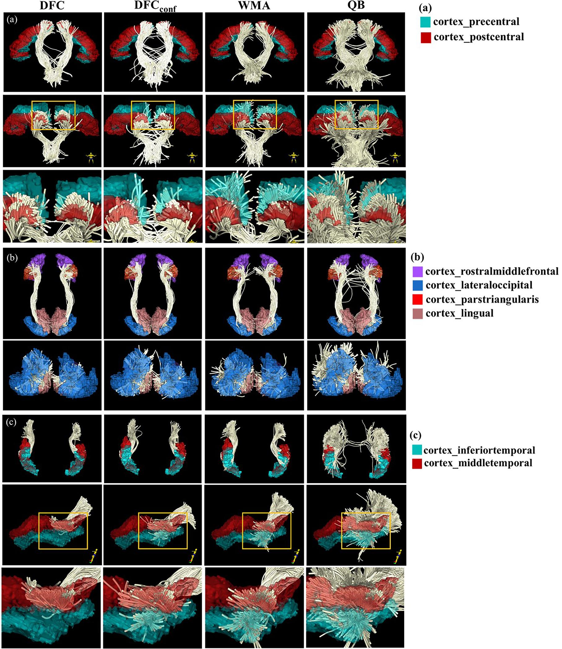 https://cdn.ncbi.nlm.nih.gov/pmc/blobs/f8be/10958986/37b6f00f67b4/nihms-1972403-f0004.jpg