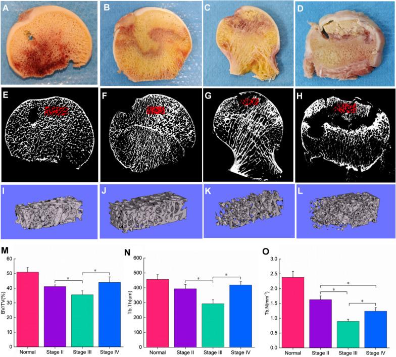 https://cdn.ncbi.nlm.nih.gov/pmc/blobs/f8bf/10523670/1f3ffbdac498/13018_2023_4153_Fig5_HTML.jpg