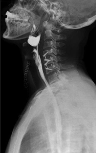 https://cdn.ncbi.nlm.nih.gov/pmc/blobs/f8bf/7057907/34a25c49bd83/AJNS-15-218-g004.jpg