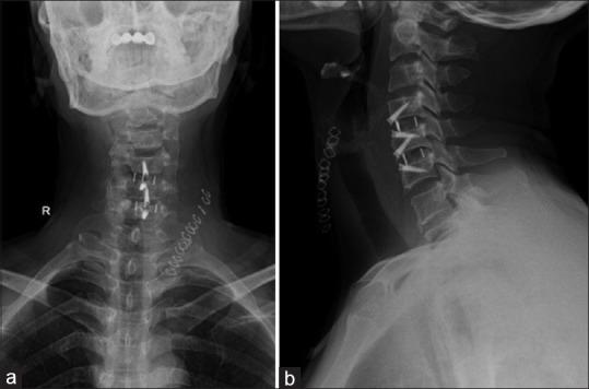 https://cdn.ncbi.nlm.nih.gov/pmc/blobs/f8bf/7057907/741bade8d5ac/AJNS-15-218-g003.jpg