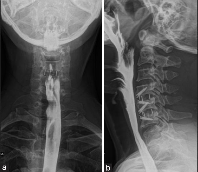 https://cdn.ncbi.nlm.nih.gov/pmc/blobs/f8bf/7057907/a920e61440a7/AJNS-15-218-g005.jpg
