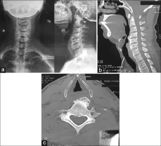 https://cdn.ncbi.nlm.nih.gov/pmc/blobs/f8bf/7057907/c9f2b86868a4/AJNS-15-218-g001.jpg