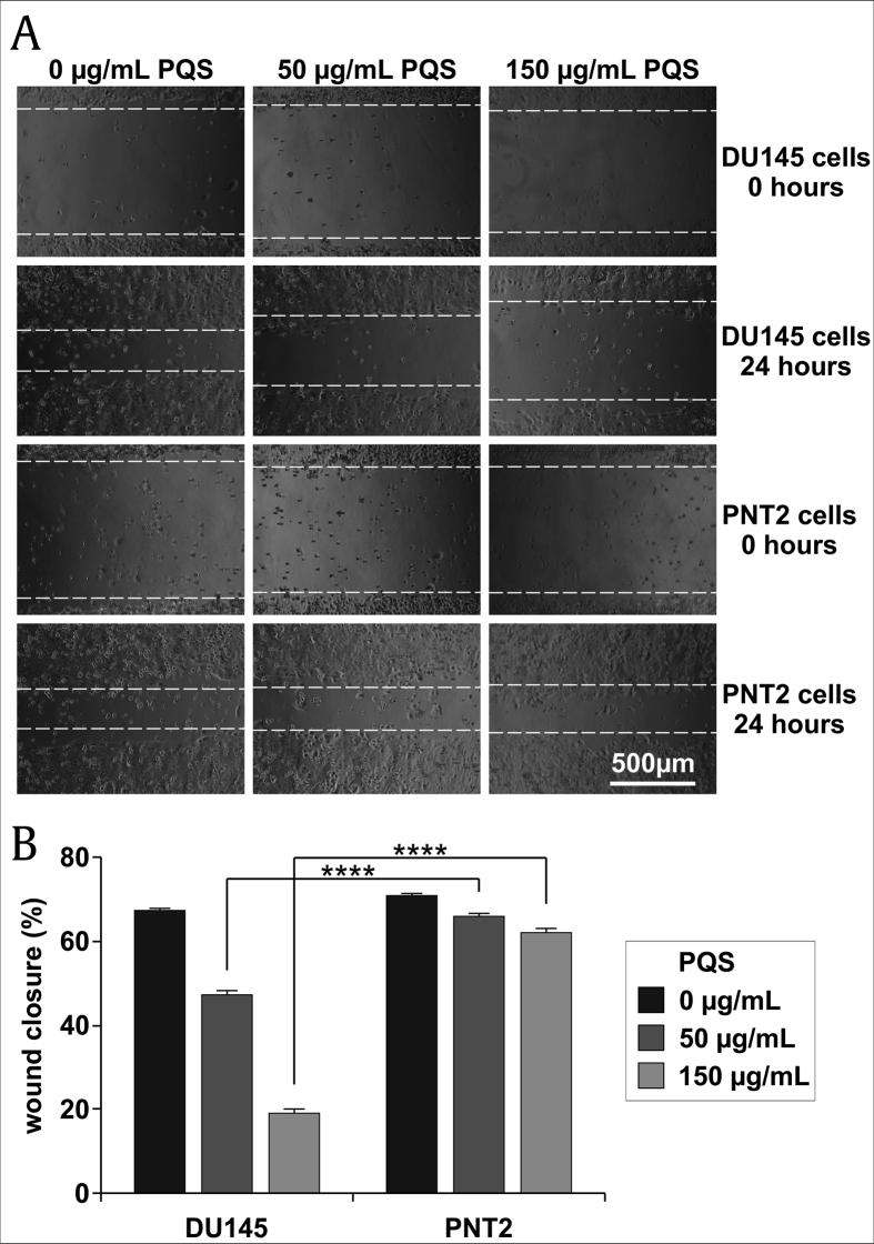 https://cdn.ncbi.nlm.nih.gov/pmc/blobs/f8c5/8020356/83ddb7f96afe/gr5.jpg